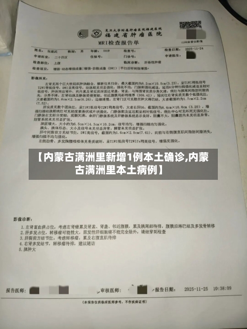 【内蒙古满洲里新增1例本土确诊,内蒙古满洲里本土病例】-第2张图片
