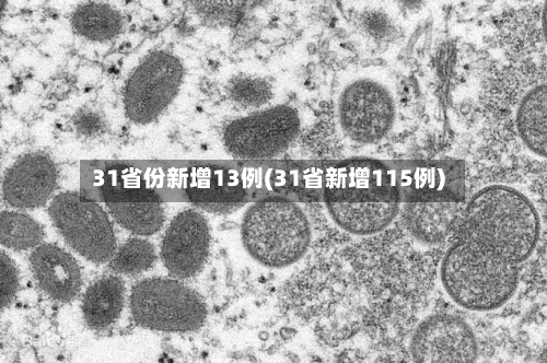 31省份新增13例(31省新增115例)-第3张图片