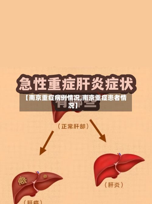 【南京重症病例情况,南京重症患者情况】