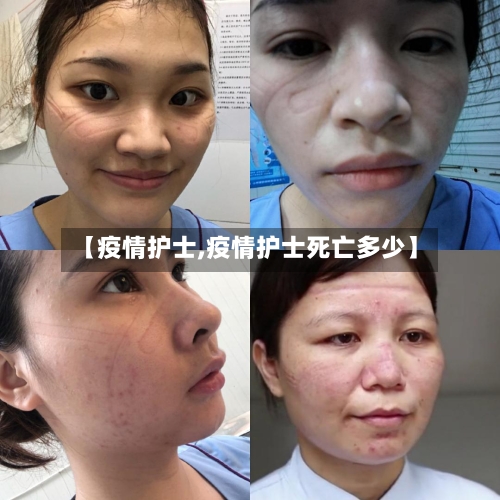 【疫情护士,疫情护士死亡多少】-第1张图片
