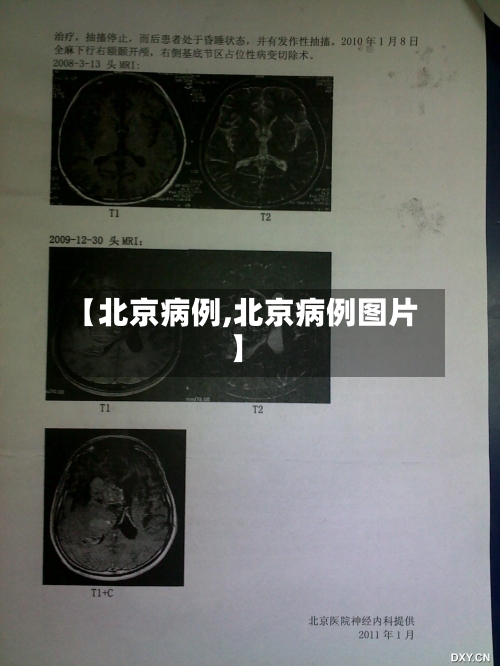 【北京病例,北京病例图片】