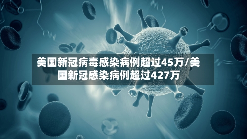 美国新冠病毒感染病例超过45万/美国新冠感染病例超过427万-第1张图片