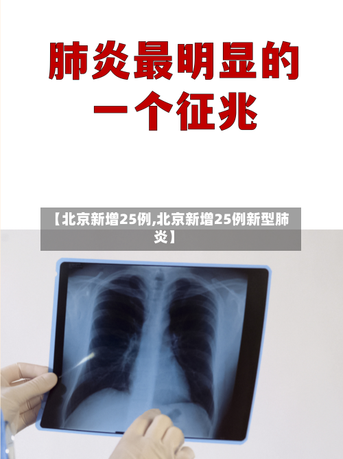 【北京新增25例,北京新增25例新型肺炎】-第3张图片