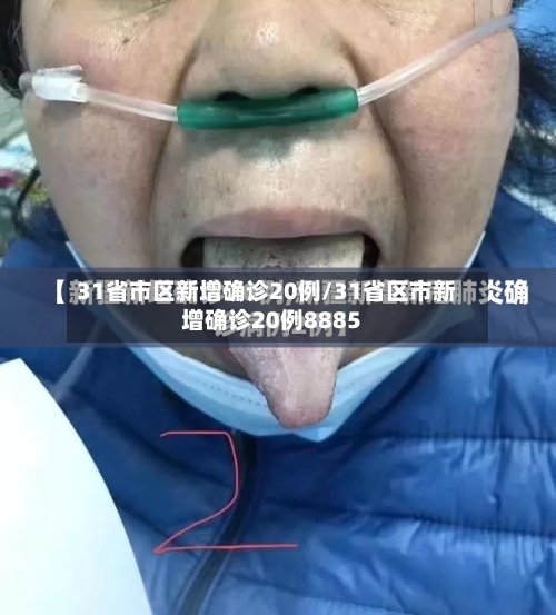 31省市区新增确诊20例/31省区市新增确诊20例8885-第2张图片