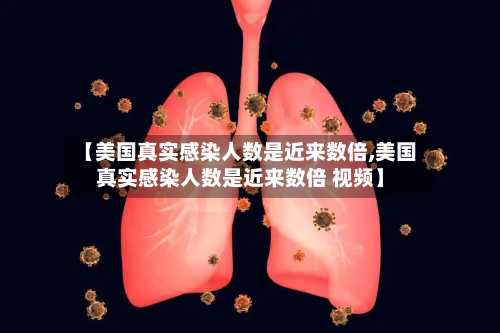 【美国真实感染人数是近来数倍,美国真实感染人数是近来数倍 视频】-第2张图片