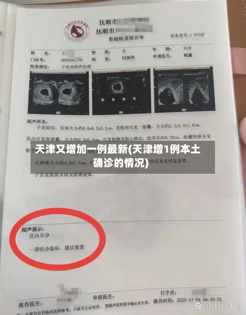天津又增加一例最新(天津增1例本土确诊的情况)