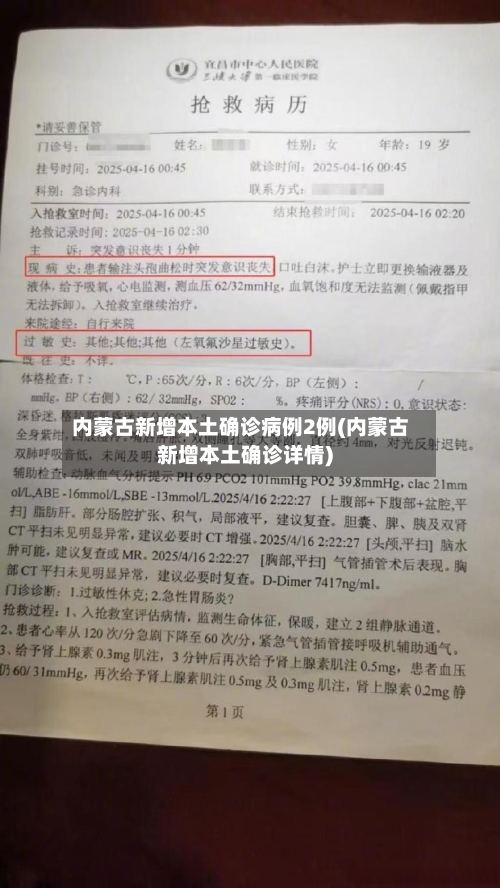 内蒙古新增本土确诊病例2例(内蒙古新增本土确诊详情)-第2张图片