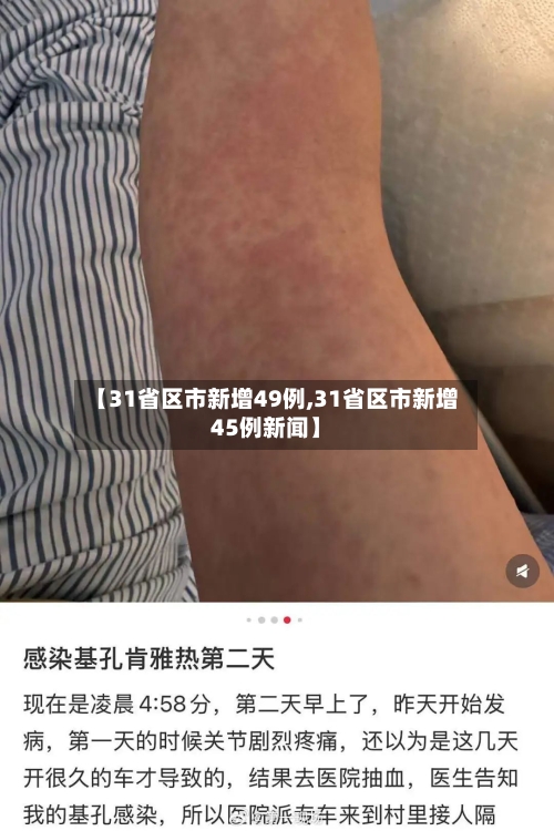 【31省区市新增49例,31省区市新增45例新闻】-第3张图片