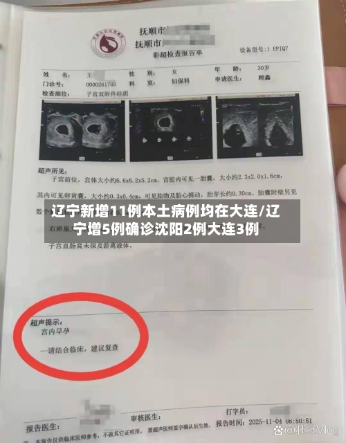 辽宁新增11例本土病例均在大连/辽宁增5例确诊沈阳2例大连3例