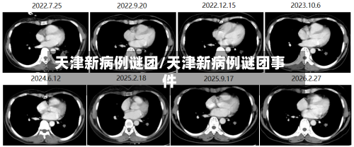天津新病例谜团/天津新病例谜团事件-第3张图片