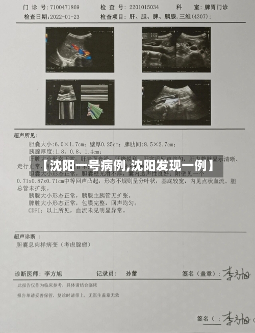 【沈阳一号病例,沈阳发现一例】